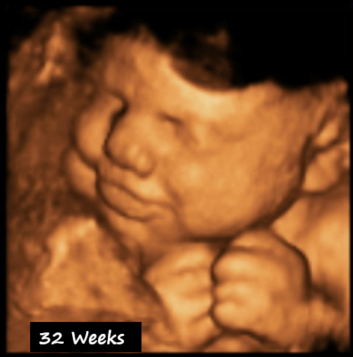 4D Ultrasound Visalia 